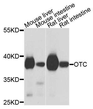 OTC Antibody - Western blot analysis of extracts of various cells.