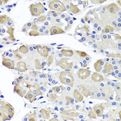 OTC Antibody - Immunohistochemistry of paraffin-embedded human stomach tissue.