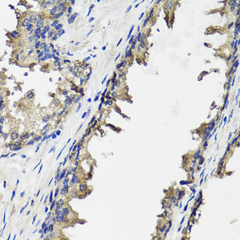 OTC Antibody - Immunohistochemistry of paraffin-embedded human prostate.
