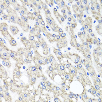 OTC Antibody - Immunohistochemistry of paraffin-embedded human liver injury tissue.