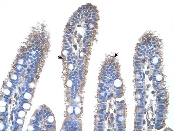 OTC Antibody - OTC antibody ARP41766_T100-NP_000522-OTC(ornithine carbamoyltransferase) Antibody was used in IHC to stain formalin-fixed, paraffin-embedded human intestine.  This image was taken for the unconjugated form of this product. Other forms have not been tested.