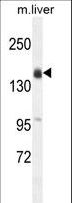 OTOA Antibody - OTOA Antibody western blot of mouse liver tissue lysates (35 ug/lane). The OTOA antibody detected the OTOA protein (arrow).