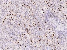 OTOA Antibody - Immunochemical staining of human OTOA in human spleen with rabbit polyclonal antibody at 1:300 dilution, formalin-fixed paraffin embedded sections.