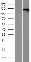 OTOA Protein - Western validation with an anti-DDK antibody * L: Control HEK293 lysate R: Over-expression lysate