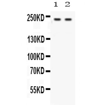 OTOF / Otoferlin Antibody - Otoferlin antibody Western blot. All lanes: Anti Otoferlin at 0.5 ug/ml. Lane 1: Rat Cardiac Muscle Tissue Lysate at 50 ug. Lane 2: 293T Whole Cell Lysate at 40 ug. Predicted band size: 227 kD. Observed band size: 227 kD.