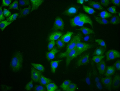 OTOP1 Antibody - Immunofluorescence staining of Hela cells diluted at 1:133, counter-stained with DAPI. The cells were fixed in 4% formaldehyde, permeabilized using 0.2% Triton X-100 and blocked in 10% normal Goat Serum. The cells were then incubated with the antibody overnight at 4°C.The Secondary antibody was Alexa Fluor 488-congugated AffiniPure Goat Anti-Rabbit IgG (H+L).