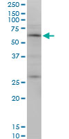 OTOP2 Antibody - OTOP2 monoclonal antibody (M10), clone 4F6. Western blot of OTOP2 expression in MCF-7.