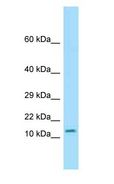 OTOS Antibody - OTOS antibody Western Blot of Mouse Pancreas.  This image was taken for the unconjugated form of this product. Other forms have not been tested.