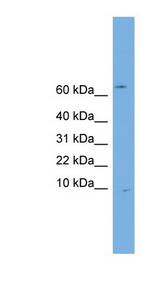 OTOS Antibody - OTOS antibody Western blot of Jurkat lysate. This image was taken for the unconjugated form of this product. Other forms have not been tested.