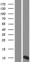 OTOS Protein - Western validation with an anti-DDK antibody * L: Control HEK293 lysate R: Over-expression lysate