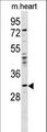 OTP Antibody - OTP Antibody western blot of mouse heart tissue lysates (35 ug/lane). The OTP antibody detected the OTP protein (arrow).