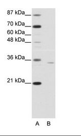 OTP Antibody - A: Marker, B: Jurkat Cell Lysate.  This image was taken for the unconjugated form of this product. Other forms have not been tested.