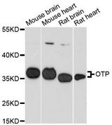 OTP Antibody - Western blot analysis of extracts of various cell lines, using OTP antibody at 1:3000 dilution. The secondary antibody used was an HRP Goat Anti-Rabbit IgG (H+L) at 1:10000 dilution. Lysates were loaded 25ug per lane and 3% nonfat dry milk in TBST was used for blocking. An ECL Kit was used for detection and the exposure time was 90s.
