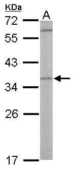OTUB1 / OTU1 Antibody - Sample (50 ug of whole cell lysate). A: Mouse liver. 12% SDS PAGE. OTUB1 / OTU1 antibody diluted at 1:500.