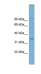 OTUB1 / OTU1 Antibody - OTUB1 antibody Western blot of THP-1 cell lysate. This image was taken for the unconjugated form of this product. Other forms have not been tested.