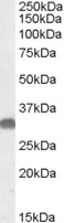 OTUB1 / OTU1 Antibody - Antibody (0.05 ug/ml) staining of Mouse Brain lysate (35 ug protein in RIPA buffer). Primary incubation was 1 hour. Detected by chemiluminescence