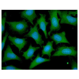 OTUB1 / OTU1 Antibody - ICC/IF analysis of OTUB1 in HeLa cells line, stained with DAPI (Blue) for nucleus staining and monoclonal anti-human OTUB1 antibody (1:100) with goat anti-mouse IgG-Alexa fluor 488 conjugate (Green).
