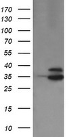 OTUB1 / OTU1 Antibody - HEK293T cells were transfected with the pCMV6-ENTRY control (Left lane) or pCMV6-ENTRY OTUB1 (Right lane) cDNA for 48 hrs and lysed. Equivalent amounts of cell lysates (5 ug per lane) were separated by SDS-PAGE and immunoblotted with anti-OTUB1.