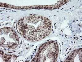 OTUB1 / OTU1 Antibody - IHC of paraffin-embedded Human breast tissue using anti-OTUB1 mouse monoclonal antibody.