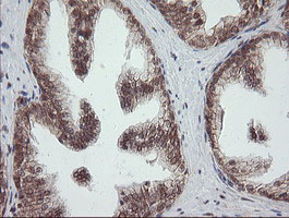 OTUB1 / OTU1 Antibody - IHC of paraffin-embedded Human prostate tissue using anti-OTUB1 mouse monoclonal antibody.