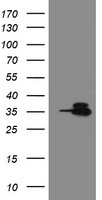 OTUB1 / OTU1 Antibody - HEK293T cells were transfected with the pCMV6-ENTRY control (Left lane) or pCMV6-ENTRY OTUB1 (Right lane) cDNA for 48 hrs and lysed. Equivalent amounts of cell lysates (5 ug per lane) were separated by SDS-PAGE and immunoblotted with anti-OTUB1.