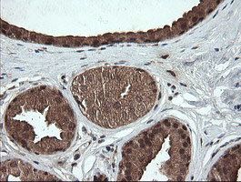 OTUB1 / OTU1 Antibody - IHC of paraffin-embedded Human breast tissue using anti-OTUB1 mouse monoclonal antibody.