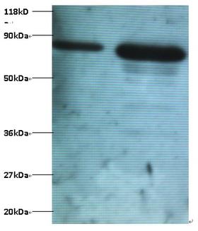 OTUB1 / OTU1 Antibody - Western blot of Ubiquitin thioesterase OTUB1 antibody at 2 ug/ml. Lane 1: EC109 whole cell lysate. Lane 2: 293T whole cell lysate. Secondary: Goat polyclonal to Rabbit IgG at 1:15000 dilution. Predicted band size: 20 kDa. Observed band size: 80 kDa.  This image was taken for the unconjugated form of this product. Other forms have not been tested.