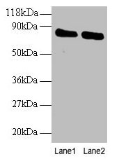 OTUB1 / OTU1 Antibody - Western blot All lanes: Ubiquitin thioesterase OTUB1 antibody at 2µg/ml Lane 1: EC109 whole cell lysate Lane 2: 293T whole cell lysate Secondary Goat polyclonal to rabbit IgG at 1/15000 dilution Predicted band size: 32, 36 kDa Observed band size: 80 kDa