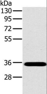 OTUB1 / OTU1 Antibody - Western blot analysis of Mouse brain tissue, using OTUB1 Polyclonal Antibody at dilution of 1:800.
