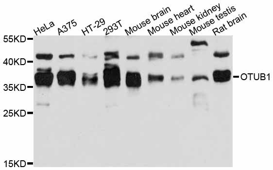 OTUB1 / OTU1 Antibody - Western blot analysis of extracts of various cell lines, using OTUB1 antibody at 1:3000 dilution. The secondary antibody used was an HRP Goat Anti-Rabbit IgG (H+L) at 1:10000 dilution. Lysates were loaded 25ug per lane and 3% nonfat dry milk in TBST was used for blocking. An ECL Kit was used for detection and the exposure time was 15s.