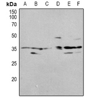 OTUB1 / OTU1 Antibody - Western blot analysis of OUTB1 expression in HEK293T (A), Jurkat (B), NIH3T3 (C), mouse brain (D), H9C2 (E), PC12 (F) whole cell lysates.