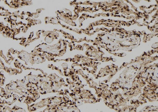 OTUB1 / OTU1 Antibody - 1:100 staining human lung tissue by IHC-P. The sample was formaldehyde fixed and a heat mediated antigen retrieval step in citrate buffer was performed. The sample was then blocked and incubated with the antibody for 1.5 hours at 22°C. An HRP conjugated goat anti-rabbit antibody was used as the secondary.