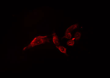 OTUB1 / OTU1 Antibody - Staining HeLa cells by IF/ICC. The samples were fixed with PFA and permeabilized in 0.1% Triton X-100, then blocked in 10% serum for 45 min at 25°C. The primary antibody was diluted at 1:200 and incubated with the sample for 1 hour at 37°C. An Alexa Fluor 594 conjugated goat anti-rabbit IgG (H+L) antibody, diluted at 1/600, was used as secondary antibody.