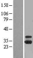 OTUB1 / OTU1 Protein - Western validation with an anti-DDK antibody * L: Control HEK293 lysate R: Over-expression lysate