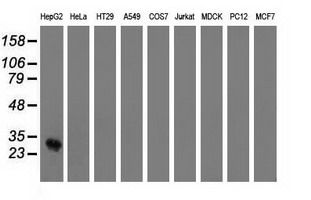 OTUB2 Antibody - Western blot of extracts (35 ug) from 9 different cell lines by using anti-OTUB2 monoclonal antibody.