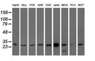 OTUB2 Antibody - Western blot of extracts (35 ug) from 9 different cell lines by using anti-OTUB2 monoclonal antibody.