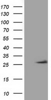 OTUB2 Antibody - HEK293T cells were transfected with the pCMV6-ENTRY control (Left lane) or pCMV6-ENTRY OTUB2 (Right lane) cDNA for 48 hrs and lysed. Equivalent amounts of cell lysates (5 ug per lane) were separated by SDS-PAGE and immunoblotted with anti-OTUB2.