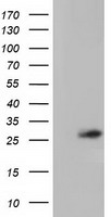 OTUB2 Antibody - HEK293T cells were transfected with the pCMV6-ENTRY control (Left lane) or pCMV6-ENTRY OTUB2 (Right lane) cDNA for 48 hrs and lysed. Equivalent amounts of cell lysates (5 ug per lane) were separated by SDS-PAGE and immunoblotted with anti-OTUB2.