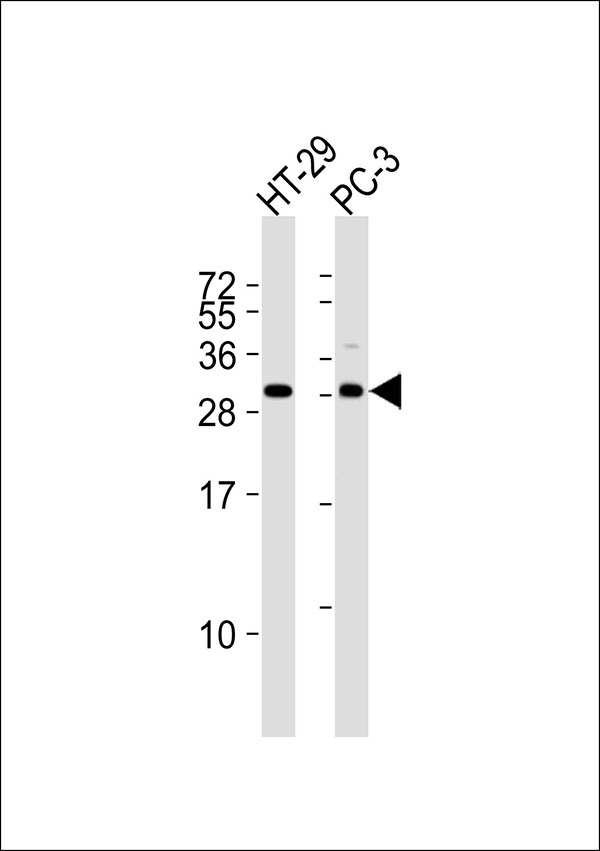 OTUB2 Antibody - All lanes : Anti-OTUB2 Antibody at 1:1000 dilution Lane 1: HT-29 whole cell lysates Lane 2: PC-3 whole cell lysates Lysates/proteins at 20 ug per lane. Secondary Goat Anti-Rabbit IgG, (H+L),Peroxidase conjugated at 1/10000 dilution Predicted band size : 27 kDa Blocking/Dilution buffer: 5% NFDM/TBST.