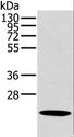 OTUB2 Antibody - Western blot analysis of Human liver cancer tissue, using OTUB2 Polyclonal Antibody at dilution of 1:800.