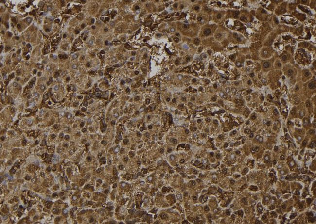 OTUB2 Antibody - 1:100 staining human liver tissue by IHC-P. The sample was formaldehyde fixed and a heat mediated antigen retrieval step in citrate buffer was performed. The sample was then blocked and incubated with the antibody for 1.5 hours at 22°C. An HRP conjugated goat anti-rabbit antibody was used as the secondary.