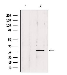 OTUB2 Antibody - Western blot analysis of extracts of various samples using OTUB2 antibody. Lane 1: 293 treated with blocking peptide. Lane 2: 293; Lane 3: HeLa;