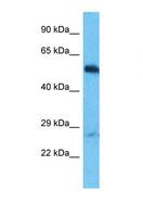 OTUD1 Antibody - Western blot of Human HepG2. OTUD1 antibody dilution 1.0 ug/ml.  This image was taken for the unconjugated form of this product. Other forms have not been tested.