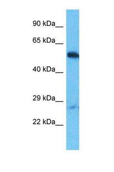 OTUD1 Antibody - Western blot of Human HepG2. OTUD1 antibody dilution 1.0 ug/ml.  This image was taken for the unconjugated form of this product. Other forms have not been tested.