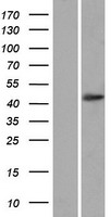 OTUD3 Protein - Western validation with an anti-DDK antibody * L: Control HEK293 lysate R: Over-expression lysate