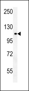 OTUD4 Antibody - OTUD4 Antibody western blot of MDA-MB435 cell line lysates (35 ug/lane). The OTUD4 antibody detected the OTUD4 protein (arrow).