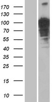 OTUD4 Protein - Western validation with an anti-DDK antibody * L: Control HEK293 lysate R: Over-expression lysate