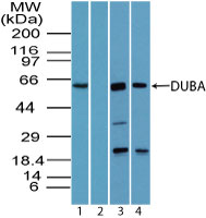 OTUD5 Antibody - Western blot of DUBA in human liver lysate in the 1) absence and 2) presence of immunizing peptide, 3) mouse liver lysate and 4) rat liver lysate using Polyclonal Antibody to DUBA at 4 ug/ml. Goat anti-rabbit Ig HRP secondary antibody, and PicoTect ECL substrate solution, were used for this test.