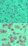 OTUD5 Antibody - IHC of DUBA in formalin-fixed, paraffin-embedded human liver tissue using an isotype control (top) and Polyclonal Antibody to DUBA (bottom) at 5 ug/ml.