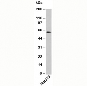 OTUD5 Antibody - OTUD5 antibody western blot of mouse samples